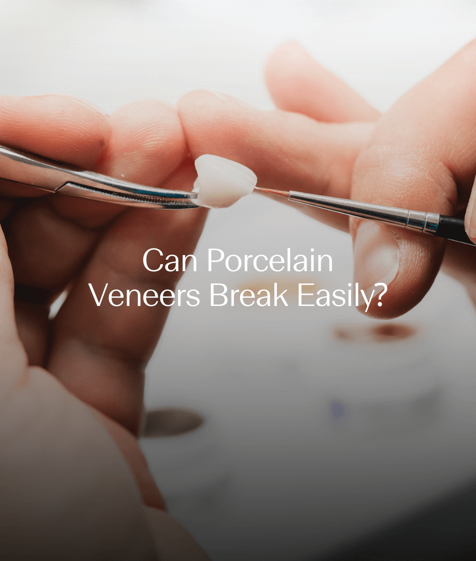 Can Porcelain Veneers Break Easily?