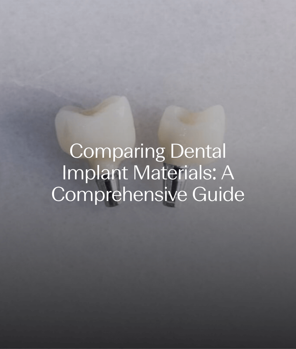 Comparing Dental Implant Materials: A Comprehensive Guide
